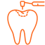 Home tooth filling